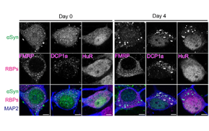科學家發(fā)現(xiàn)了引發(fā)帕金森病的隱藏RNA結(jié)構
