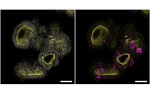 Cell：突破類器官研究限制！利用所有關鍵的胰腺細胞創(chuàng)造了一個新的類器官