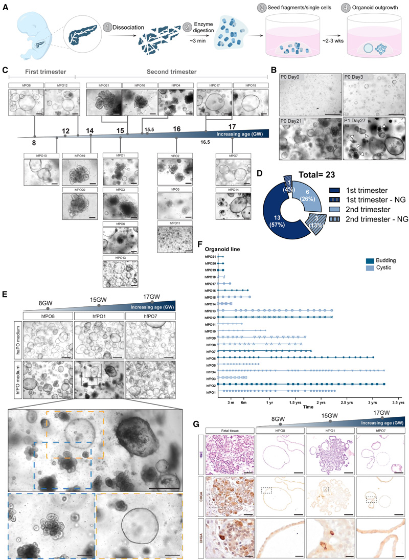 人胎兒胰腺類(lèi)器官的建立