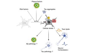 《Neuron》阿爾茨海默氏癥背后隱藏的罪魁禍首：顯微鏡下看小膠質(zhì)細胞