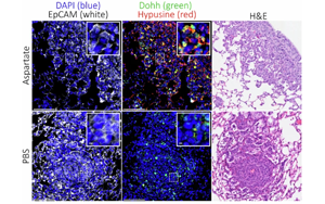 Nature：癌癥轉(zhuǎn)移時(shí)為何青睞肺部？