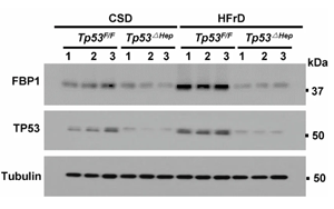 《Nature》脂肪肝為什么會(huì)導(dǎo)致肝癌？