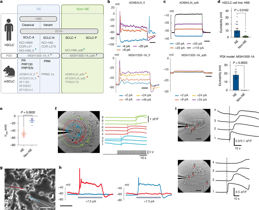 電激活的NE細(xì)胞產(chǎn)生自發(fā)和誘發(fā)的鈣波 電激活的NE細(xì)胞產(chǎn)生自發(fā)和誘發(fā)的鈣波