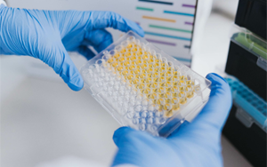 免疫技術(shù)新視界：層析、印跡、吸附與比濁的前沿碰撞