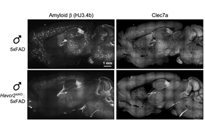 Nature：在大腦免疫細胞中發(fā)現(xiàn)潛在的阿爾茨海默病治療靶點