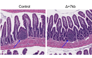 Nature：科學家新發(fā)現(xiàn)一種免疫細胞類型，與過敏有關