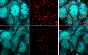 重大發(fā)現！阿爾茨海默病患者來源的高分子量 tau 蛋白如何 “破壞” 海馬神經元？