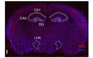 Nature：科學家發(fā)現記憶如何控制新陳代謝