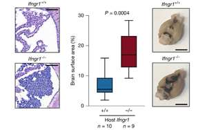 干擾素 -γ（IFNγ）調(diào)控軟腦膜抗腫瘤免疫應答的機制研究
