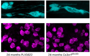 《Nature Neuroscience》大腦白質(zhì)為何隨年齡退化？因?yàn)槊庖呒?xì)胞“勾心斗角”