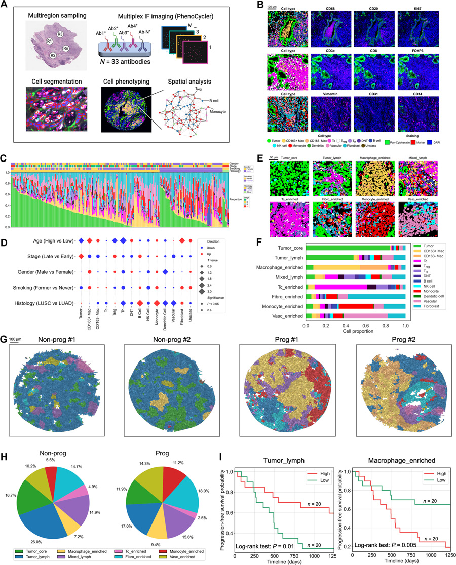 基于多重免疫熒光成像(mIF)的非小細(xì)胞肺癌組織微環(huán)境表征 基于多重免疫熒光成像(mIF)的非小細(xì)胞肺癌組織微環(huán)境表征