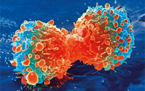 Nature Genetics：腫瘤轉(zhuǎn)移過程中會(huì)積累更多的拷貝數(shù)變異，而不是突變