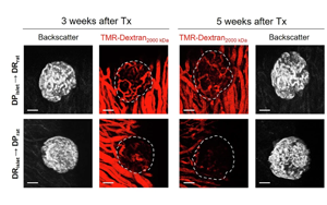 胰島微環(huán)境影響1型糖尿病發(fā)展的機(jī)制研究：基于BioBreeding大鼠模型及apoCIII靶向干預(yù)策略