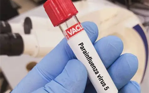 副流感病毒（HPIV1、2、3型）抗原檢測(cè)-免疫層析 （膠體金、彩色乳膠及熒光免疫層析）解決方案