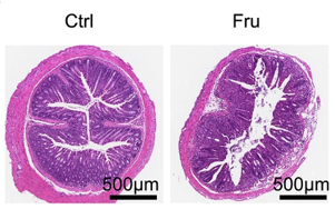 高果糖飲食通過代謝重編程促進效應(yīng)T細胞生成加劇炎癥反應(yīng)的作用機制及二甲雙胍干預(yù)研究