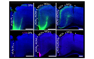 小鼠內(nèi)臟運動皮層神經(jīng)網(wǎng)絡(luò)的精細(xì)解析與功能調(diào)控機制研究