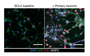 神經(jīng)元活動依賴性機制驅(qū)動小細胞肺癌發(fā)病機制的新見解