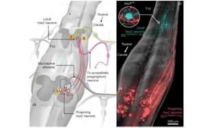 揭示自主神經反射異常（AD）的神經元架構：脊髓損傷后惡性高血壓發(fā)作的機制與神經調控治療新策略