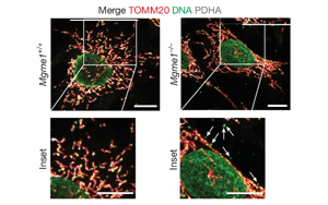 核糖核苷酸滲入線粒體DNA驅動炎癥反應——揭示核苷酸代謝失衡引發(fā)年齡相關性炎癥的新機制