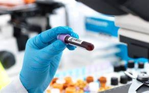 【FAPGG】，血管緊張素轉換酶檢測用底物