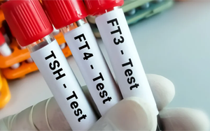 總及游離甲狀腺素（TT4及FT4）-磁微粒化學(xué)發(fā)光法（AE/AP）解決方案（雙抗體夾心法）