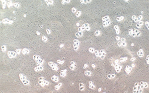 如何破解細胞培養(yǎng)中支原體污染難題