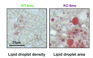 α-酮戊二酸通過調(diào)控胰島素-ATM信號軸改善共濟失調(diào)毛細血管擴張癥小鼠模型的胰島素抵抗和代謝紊亂