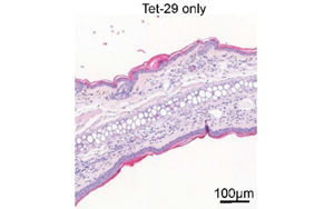 Science Signaling：深入了解糖類(lèi)如何調(diào)節(jié)炎癥性疾病過(guò)程