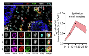 組織適應(yīng)性Treg細(xì)胞通過整合炎癥信號（IFN-γ/IL-10）激活mTORC1/Myc通路促進治療相關(guān)腸道損傷修復(fù)的新機制