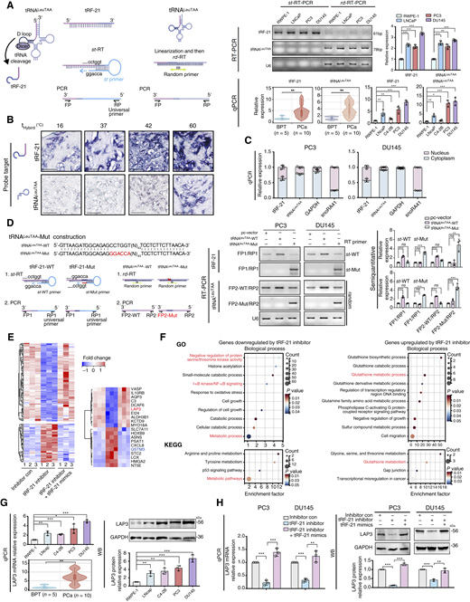 前列腺癌中tRNALeuTAA來源的小RNA tRF-21的鑒定、表征及其靶基因研究