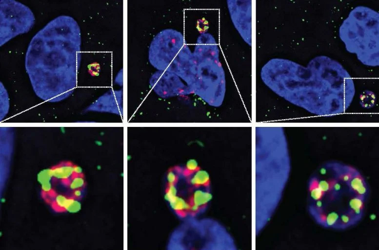 N4BP2酶（綠色）滲入微核并在其中引發(fā)DNA損傷（紅色）