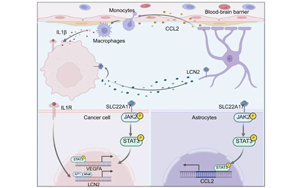 脂質運載蛋白-2通過腫瘤-微環(huán)境互作驅動肺癌腦轉移進展