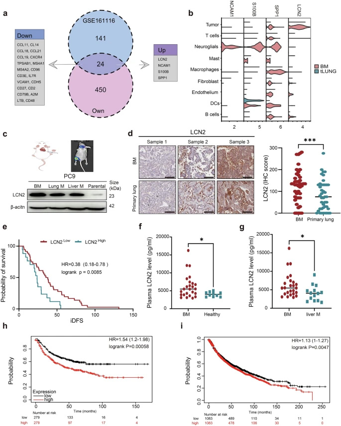 LCN2在腦轉(zhuǎn)移組織中過表達(dá)，且與肺癌患者的不良預(yù)后相關(guān)