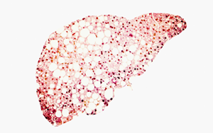Cell：高脂飲食迫使肝細胞自保，卻最終誘發(fā)肝癌