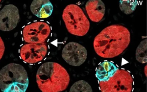 Nature 三連重磅！識(shí)破癌細(xì)胞的“詭計(jì)”，為結(jié)直腸癌患者帶來(lái)新希望