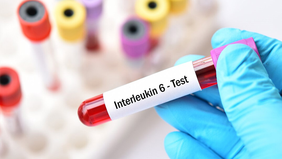 IL-6磁微?；瘜W(xué)發(fā)光熒光免疫層析